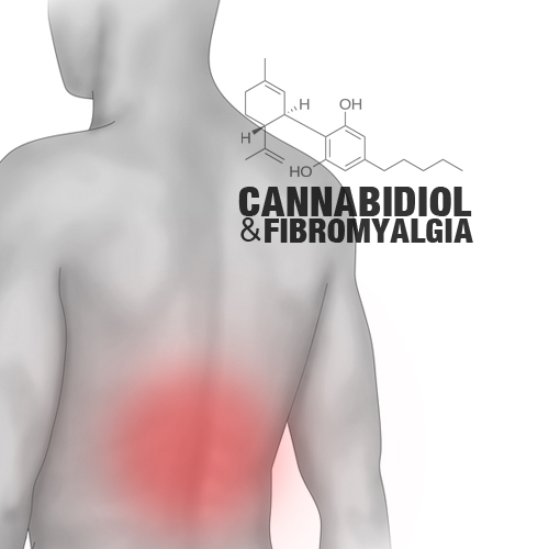Cannabidiol treatment for Fibromyalgia